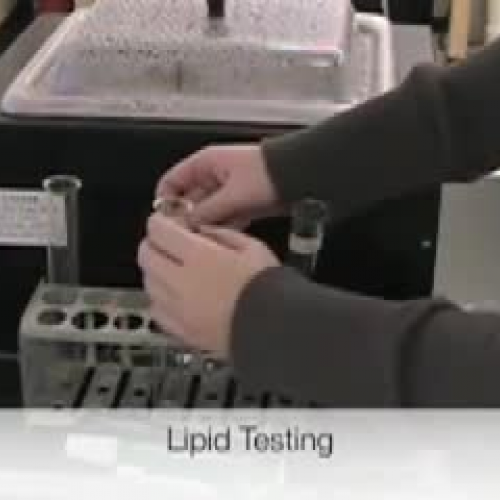 Lipid Testing
