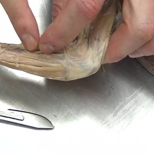 Lower Leg Dissection