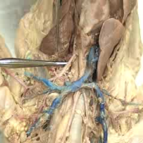Upper Arterial System