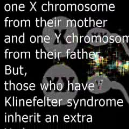 Klinfelter Syndrome