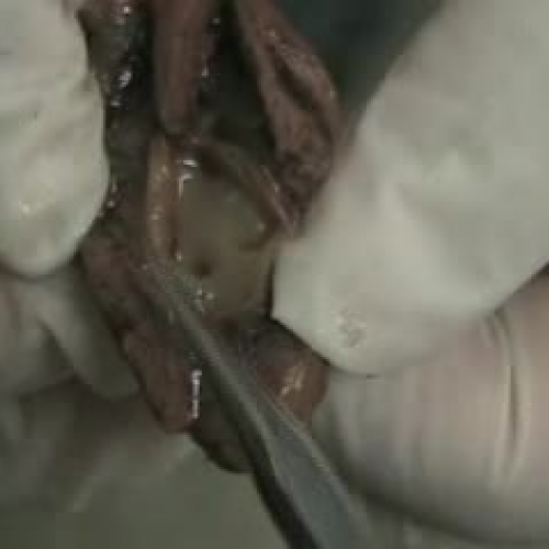 Fetal Pig Female Urinary and  Reproductive Sy