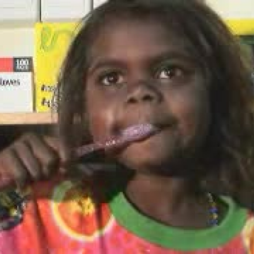 Wadeye Oral Health Program