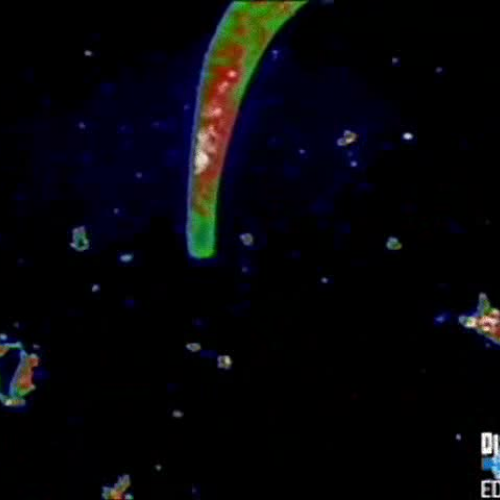 Microbial Biotechnology
