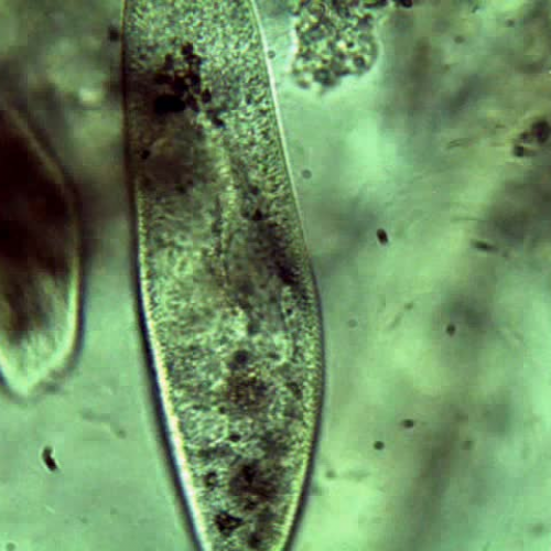 Paramecium with Food Vacuoles present