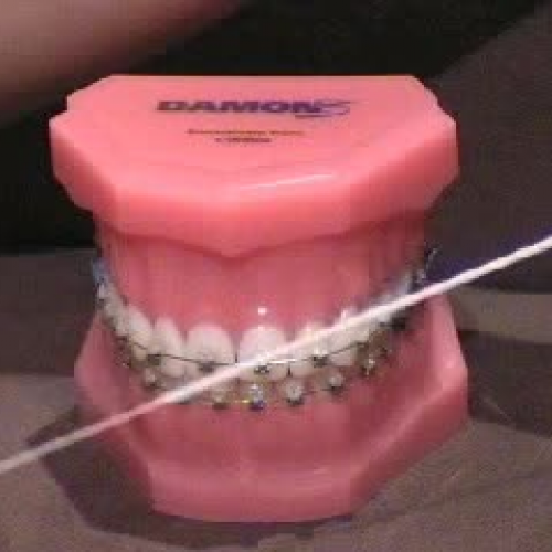Oral Hygiene Instructions for Orthodontic App