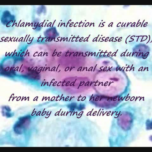Sexually Transmitted Diseases