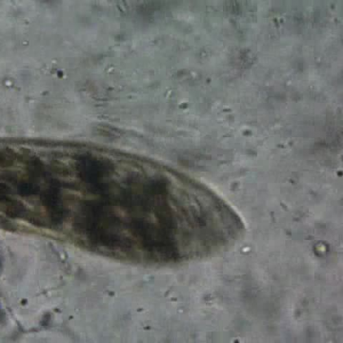 The Wild Paramecium