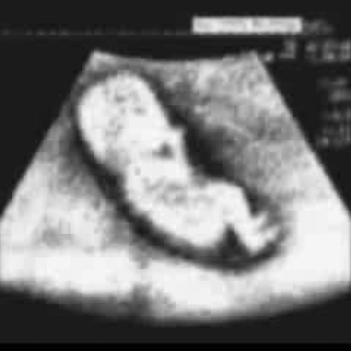 EDIT 202 Sample Video