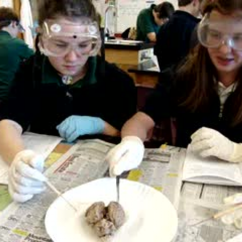 6th Grade Brain Dissection D