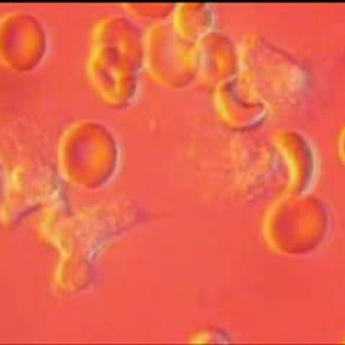 Edit 202 Immunity in Action