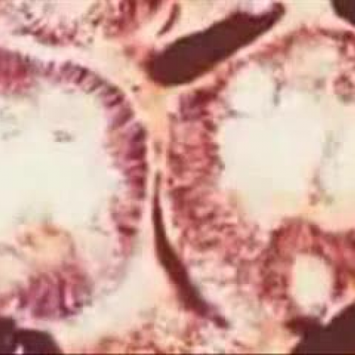 EDIT 202 Sample Video