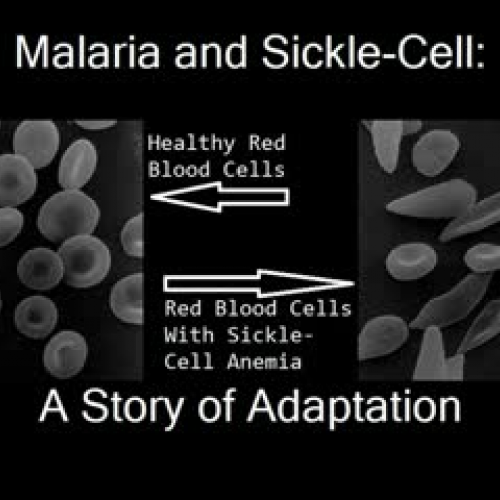 RED4043 Digital Storytelling project: Sickle 