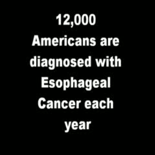 Esophageal Cancer
