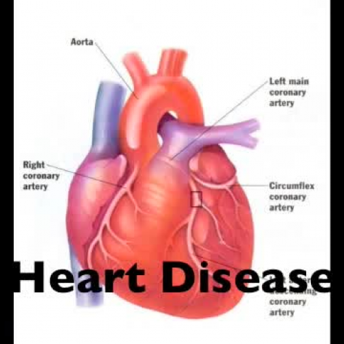 Public Service Announcement 