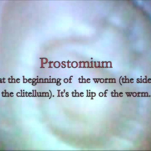 Worm Project