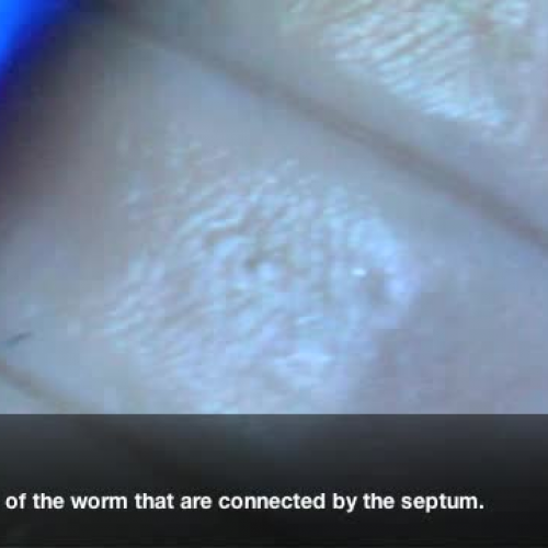 Earthworms