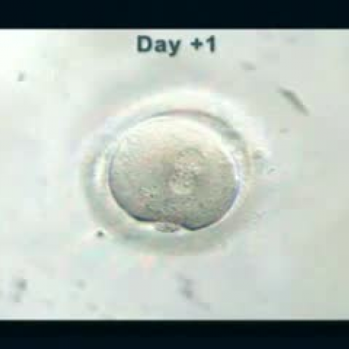 Blastocyst