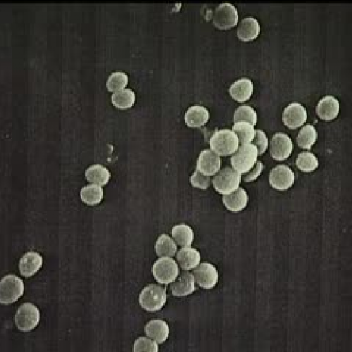 Small Things Create Huge Opportunities