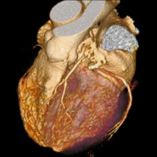 A New Source of STEM Cells