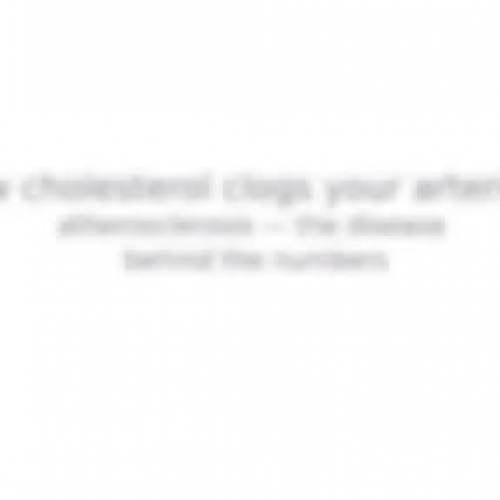 Cholesterol and plaque