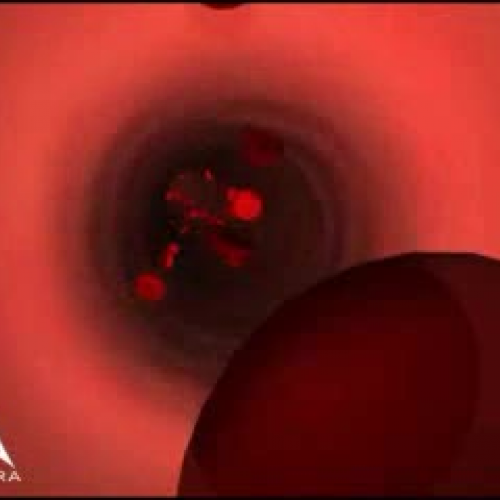 EDIT 202 Sample Video