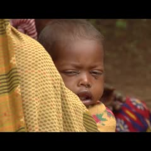 Treating Malnutrition in Famine-Affected Ethi