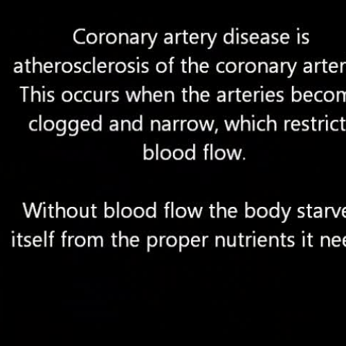 Coronary Artery Disease
