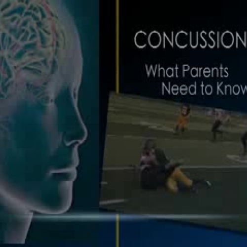 Concussion Video