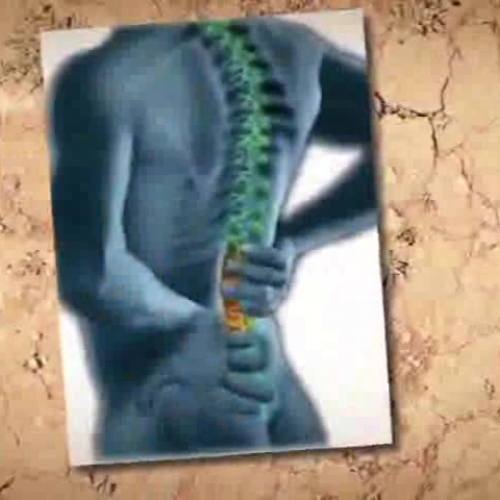 Treatment of spine problems by Spinal Fusion 