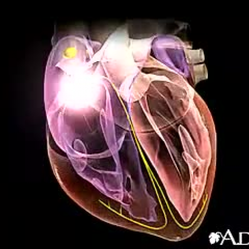 Cardiac Arrhythmia[1]