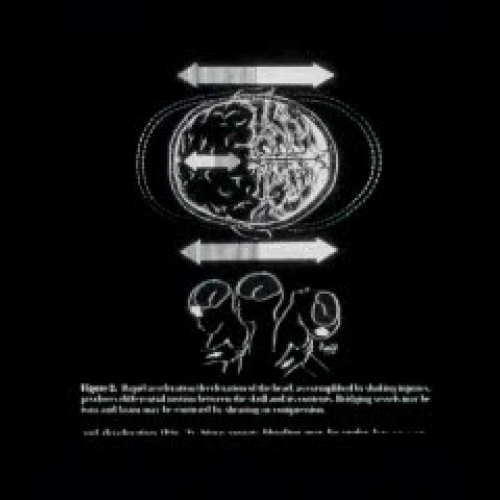 CI Child Abuse Part 2