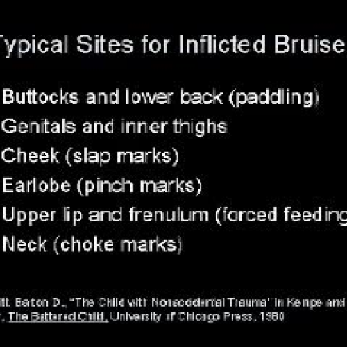 CI Child Abuse Part 1