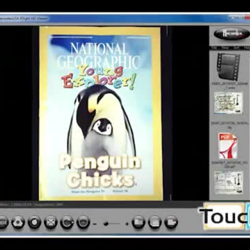 XSight XD Viewer SnapSet Feature