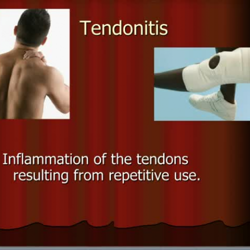 HS1 Musculoskeletal Disorders