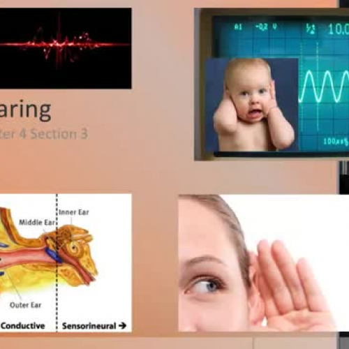 4-3- Hearing
