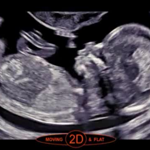 My First Foto Sonography
