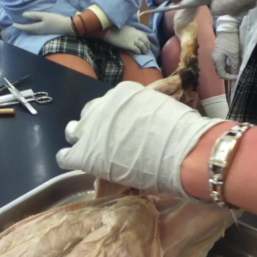 Calf muscles, Back Leg &amp; Rear Muscles