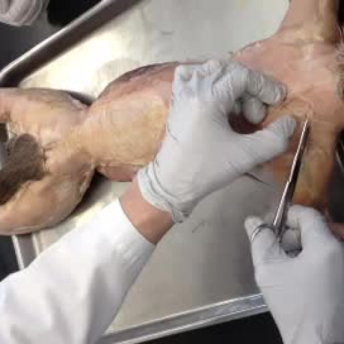 Video 1, Part 2-Levator Scapula Ventralis, se