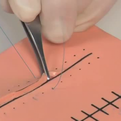 knot using needle driver