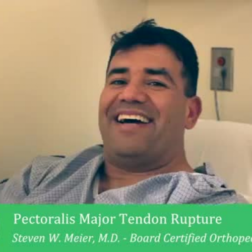 Meniscus Tear Surgery Los Angeles