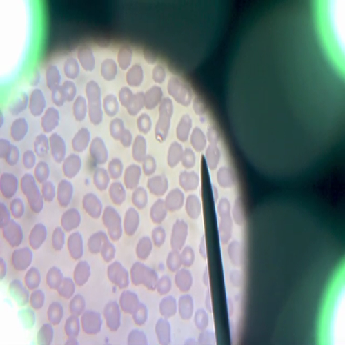 Human Blood Cells
