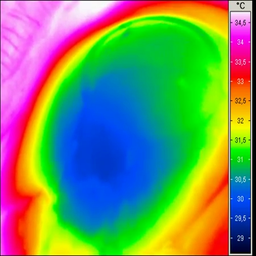 Eye Ball Thermo Energy