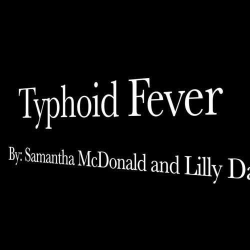 Typhoid Fever