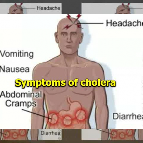 PSHA Cholera