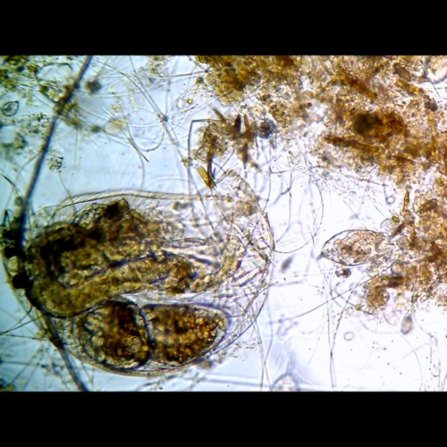 Pond Water, Daphnia, Paramecium, Rotifer