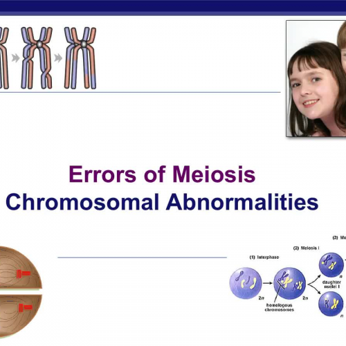 Chromosomal abnormalities