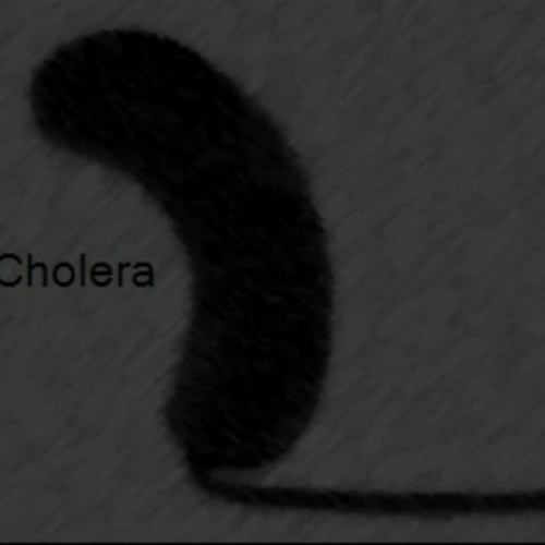Cholera Service Announcement 