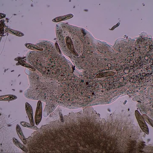 Amoeba Feeding on Paramecium