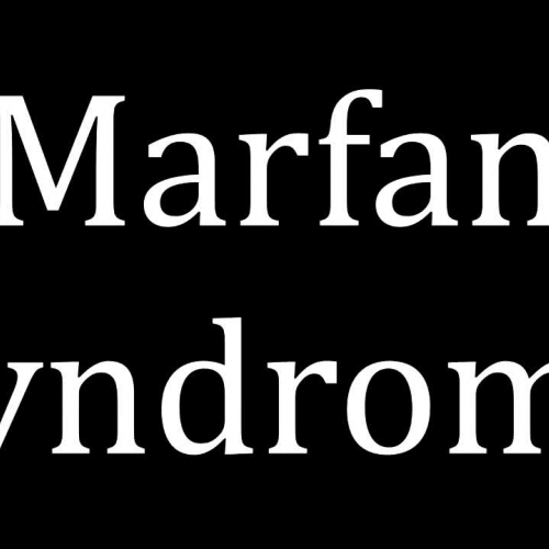 Marfan Syndrome Video