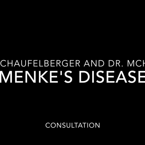 Menke's Disease Consultation Joey and Mason